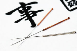 Acupuncture Brisbane